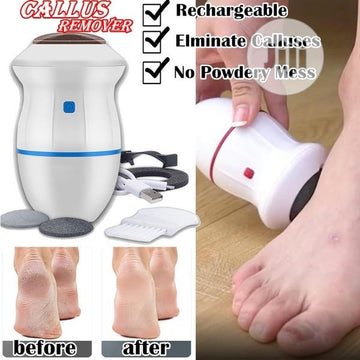 Elegant Callus Remover