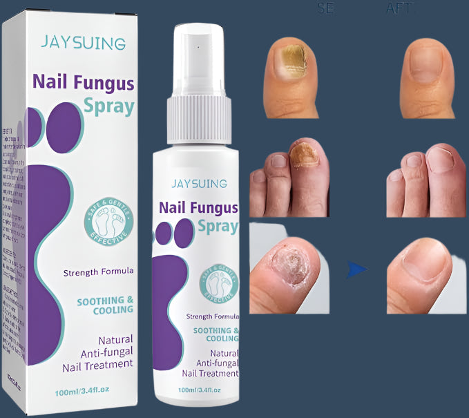 Gentle Nail Fungus Remover